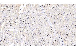 Detection of SSA1 in Human Cardiac Muscle Tissue using Polyclonal Antibody to Sjogren Syndrome Antigen A1 (SSA1)