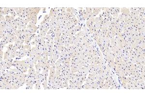 Detection of SSA1 in Human Cardiac Muscle Tissue using Polyclonal Antibody to Sjogren Syndrome Antigen A1 (SSA1) (TRIM21 anticorps  (AA 268-465))