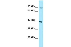 WB Suggested Anti-GPLD1 Antibody Titration: 1. (GPLD1 anticorps  (N-Term))