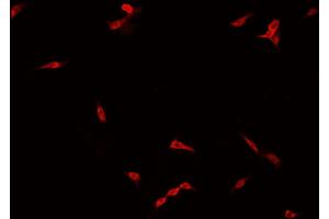 ABIN6266775 staining NCI-H929 cells by IF/ICC.