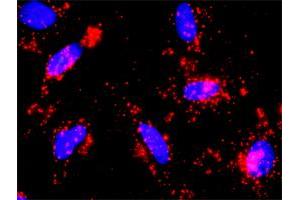 Proximity Ligation Analysis of protein-protein interactions between PIK3R1 and CTNNB1. (CTNNB1 anticorps  (AA 682-781))