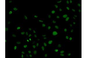 Immunofluorescence analysis of U2OS cells using PLCG2 antibody.