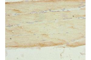 Immunohistochemistry of paraffin-embedded human skeletal muscle tissue using ABIN7146581 at dilution of 1:100