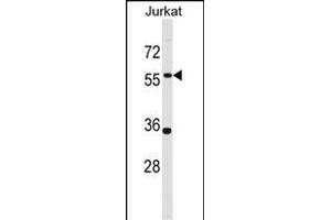 NX1 Antibody (Center) (ABIN1537796 and ABIN2848757) western blot analysis in Jurkat cell line lysates (35 μg/lane). (PANX1 anticorps  (AA 124-152))