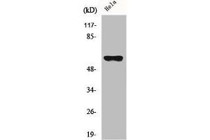 Western Blot analysis of HeLa cells using CYP27A1 Polyclonal Antibody (CYP27A1 anticorps  (Internal Region))