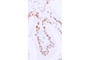 Immunohistochemistry (IHC) image for anti-Tumor Protein P53 Binding Protein 1 (TP53BP1) (AA 350-400) antibody (ABIN7448396) (TP53BP1 anticorps  (AA 350-400))