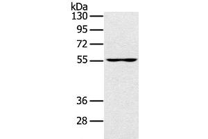 Western Blot analysis of PC3 cell using UBP1 Polyclonal Antibody at dilution of 1:200 (UBP1 anticorps)