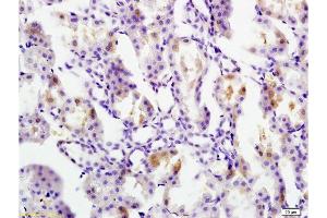 Formalin-fixed and paraffin embedded rat kidney tissue labeled with Anti Ferritin Polyclonal Antibody, Unconjugated  at 1:200 followed by conjugation to the secondary antibody and DAB staining