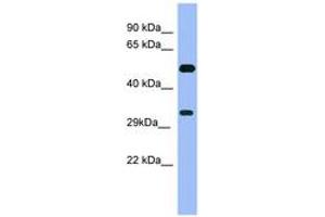 Image no. 1 for anti-Melanoma Antigen Family B, 1 (MAGEB1) (C-Term) antibody (ABIN6741714) (MAGEB1 anticorps  (C-Term))