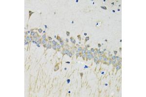 Immunohistochemistry of paraffin-embedded mouse brain using SERPINA4 antibody (ABIN4905121) at dilution of 1:100 (40x lens). (SERPINA4 anticorps)