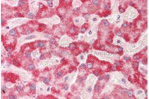 Rabbit Anti-HADH antibody Catalog Number: ARP54764 Formalin Fixed Paraffin Embedded Tissue: Human Adult Liver  Observed Staining: Cytoplasm in hepatocytes Primary Antibody Concentration: 1:600 Secondary Antibody: Donkey anti-Rabbit-Cy3 Secondary Antibody Concentration: 1:200 Magnification: 20X Exposure Time: 0. (HADH anticorps  (Middle Region))