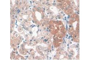 IHC-P analysis of Human Kidney Tissue, with DAB staining. (APOA1 anticorps  (AA 122-267))