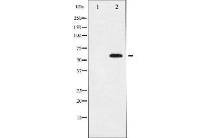 Western blot analysis of p56 Dok-2 expression in K562 whole cell lysates,The lane on the left is treated with the antigen-specific peptide.
