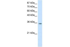 WB Suggested Anti-HOXD4 Antibody Titration:  1. (HOXD4 anticorps  (C-Term))