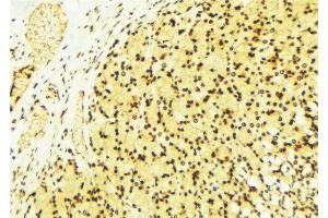 ABIN6276469 at 1/100 staining Human gastric tissue by IHC-P.