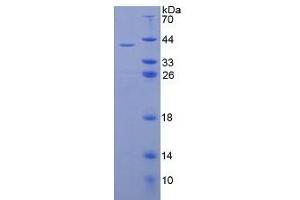 SDS-PAGE of Protein Standard from the Kit (Highly purified E. (Insulin Kit ELISA)