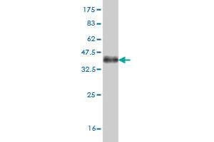 Western Blot detection against Immunogen (36. (ABL2 anticorps  (AA 743-842))