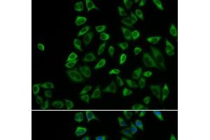 Immunofluorescence analysis of HeLa cells using PEX5 Polyclonal Antibody (PEX5 anticorps)