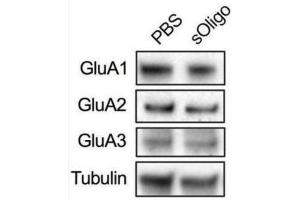 Primary cultures of rat hippocampal neurons were treated at DIV9 with either 2 μg/μl sOligo or PBS and analyses were performed at DIV16.