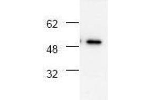 Image no. 1 for anti-Tumor Necrosis Factor Receptor Superfamily, Member 1A (TNFRSF1A) antibody (ABIN127018) (TNFRSF1A anticorps)
