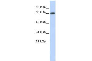 WB Suggested Anti-UGT2B15 Antibody Titration:  0.