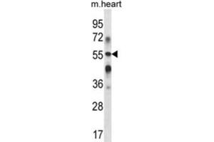 Western Blotting (WB) image for anti-UDP-Gal:betaGlcNAc beta 1,3-Galactosyltransferase, Polypeptide 2 (B3GALT2) antibody (ABIN2998023) (B3GALT2 anticorps)