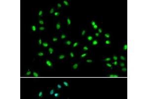 Immunofluorescence analysis of A549 cells using SMARCAD1 Polyclonal Antibody (SMARCAD1 anticorps)
