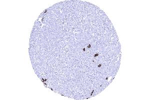 Liver Strong Trop 2 staining in intrahepatic bile ducts of the liver (Recombinant TACSTD2 anticorps  (AA 31-274))
