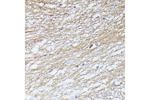 Immunohistochemistry of paraffin-embedded rat brain using Septin 5 antibody (ABIN6128759, ABIN6147556, ABIN6147557 and ABIN6216776) at dilution of 1:100 (40x lens). (Septin 5 anticorps  (AA 1-369))