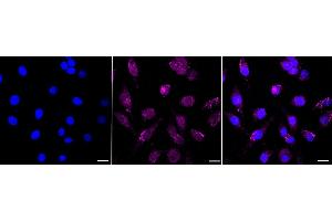 Immunocytochemical staining of HeLa cells with Nemo like kinase antibody (ABIN7799571), 1:1,000). (Recombinant Nemo-Like Kinase anticorps)