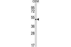 Western blot analysis of KMO Antibody (Center) in CEM cell line lysates (35ug/lane). (KMO anticorps  (Middle Region))