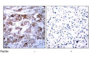 Image no. 3 for anti-B-Cell CLL/lymphoma 2 (BCL2) (Ser70) antibody (ABIN197204) (Bcl-2 anticorps  (Ser70))