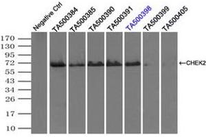 Image no. 6 for anti-Checkpoint Kinase 2 (CHEK2) antibody (ABIN1497496)