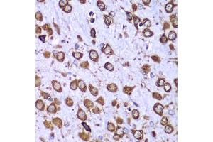 Immunohistochemistry of paraffin-embedded mouse brain using RPS10 antibody (ABIN6132945, ABIN6147192, ABIN6147194 and ABIN6221686) at dilution of 1:100 (40x lens). (RPS10 anticorps  (AA 1-165))