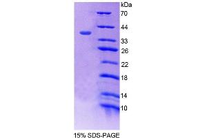 SDS-PAGE analysis of Mouse SNTb1 Protein.