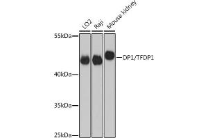 Western blot analysis of extracts of various cell lines, using DP1/DP1/TFDP1 antibody (ABIN6130313, ABIN6149038, ABIN6149040 and ABIN6221075) at 1:3000 dilution. (DP1 anticorps  (AA 1-290))