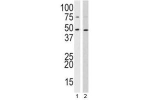 Western blot analysis of SUV39H2 antibody and 1) 293, 2) HL-60 lysate
