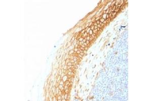 IHC testing of FFPE human tonsil tissue with Beta Catenin antibody (clone CTNNB1/1507).