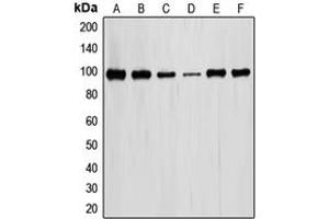 Western blot analysis of STAT6 expression in MCF7 (A), HeLa (B), HT29 (C), RAW246.