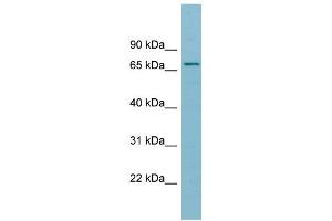 WB Suggested Anti-SLC27A5 Antibody Titration:  0. (SLC27A5 anticorps  (Middle Region))