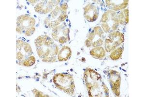 Immunohistochemistry of paraffin-embedded Human stomach using PER1 Polyclonal Antibody at dilution of 1:100 (40x lens). (PER1 anticorps)