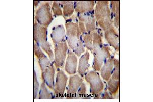 SEPN1 Antibody (C-term) (ABIN656385 and ABIN2845680) immunohistochemistry analysis in formalin fixed and paraffin embedded human skeletal muscle followed by peroxidase conjugation of the secondary antibody and DAB staining. (SEPN1 anticorps  (C-Term))