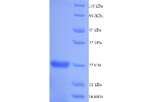 SDS-PAGE (SDS) image for Glutathione S-Transferase pi 1 (GSTP1) (AA 2-210) protein (His tag) (ABIN5713488)