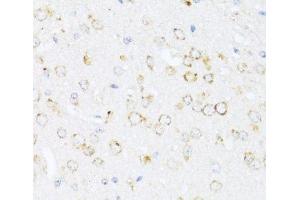 Immunohistochemistry of paraffin-embedded Mouse brain using ALOX12 Polyclonal Antibody at dilution of 1:100 (40x lens).