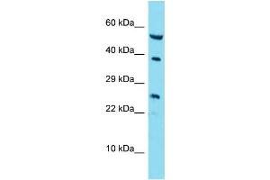 Host: Rabbit Target Name: RAB42 Sample Type: A549 Whole Cell lysates Antibody Dilution: 1. (RAB42 anticorps  (C-Term))