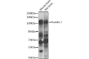 Western blot analysis of extracts of various cell lines, using Pumilio 1 antibody  at 1:1000 dilution. (PUM1 anticorps  (AA 1-280))