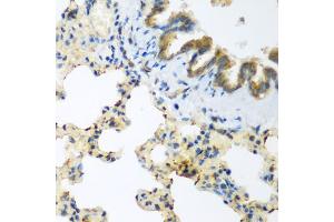 Immunohistochemistry of paraffin-embedded rat lung using LLGL2 antibody (ABIN5975836) at dilution of 1/200 (40x lens). (LLGL2 anticorps)