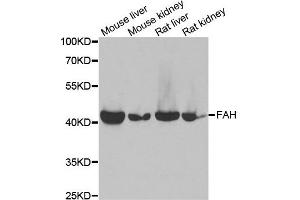 Western blot analysis of extracts of various cell lines, using FAH antibody. (FAH anticorps)