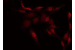 anti-Protein Kinase C, epsilon (PRKCE) (C-Term) antibody