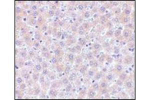 Immunohistochemistry of sRANK-L in human liver tissue with this product at 5 μg/ml.